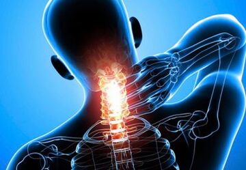starke Nackenschmerzen mit fortgeschrittener Osteochondrose