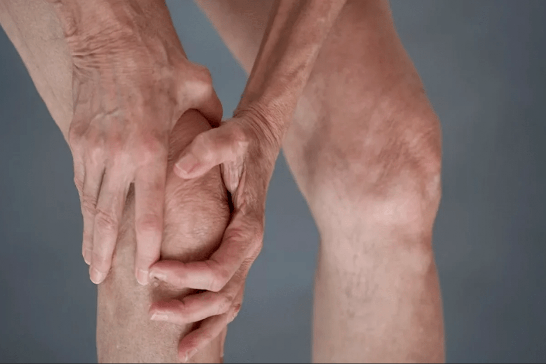 Gelenkschmerzen können die Ursache für Arthrose oder Arthritis sein. 