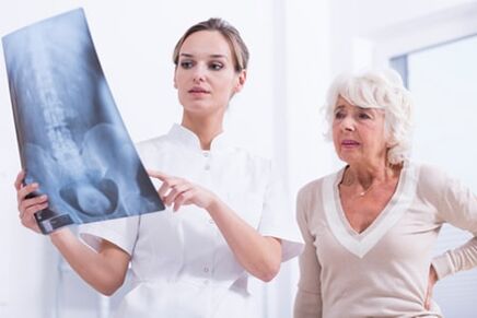 Die Röntgenuntersuchung ist eine informative Methode zur Diagnose einer Osteochondrose der Wirbelsäule. 