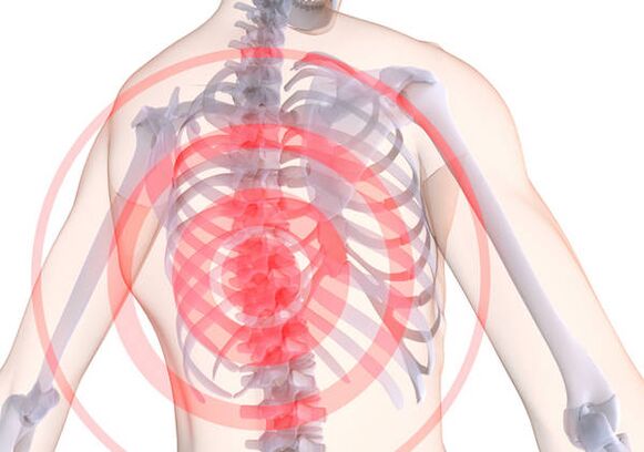 Die thorakale Osteochondrose geht mit Rückenschmerzen einher, einem stechenden Schmerz, der die Muskeln zusammenzieht. 