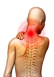 Schmerzen sind das Hauptsymptom der zervikalen Osteochondrose.