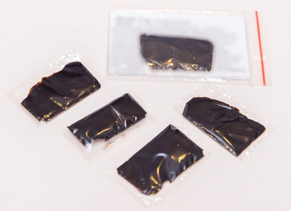 Shilajit ist ein wirksames Mittel zur Behandlung der zervikalen Osteochondrose zu Hause.